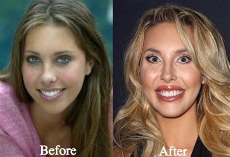 chloe lattanzi plastic|chloe lattanzi olivia newton daughter.